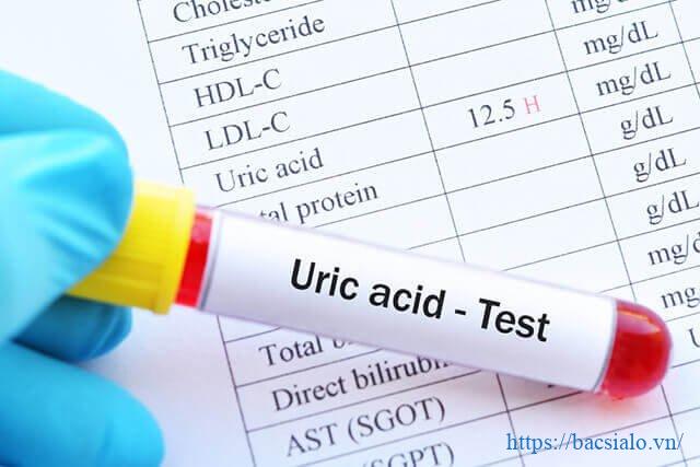 Chỉ số acid uric là gì