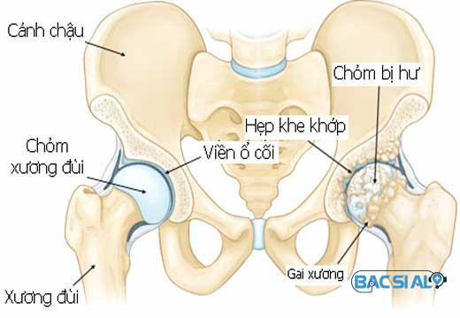 cau tao khop hang cau tao khop hang