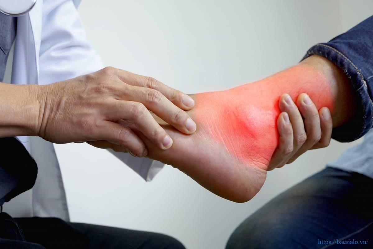 triệu chứng lâm sàng của bệnh gout