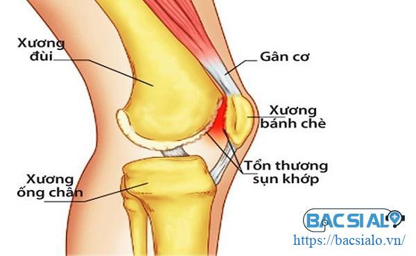 dau khop goi benh vien quoc te city