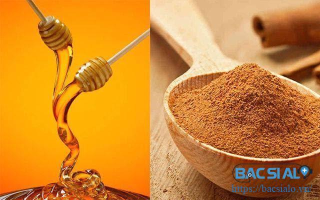 mat ong va bot que chua thoai hoa khop hang 1 Mật ong có thể hỗ trợ tái tạo dịch khớp