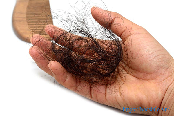 Nguyên nhân gây ra rụng tóc