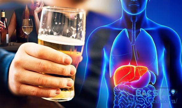 Rượu bia nguyên nhân chính gây ra gan nhiễm mỡ