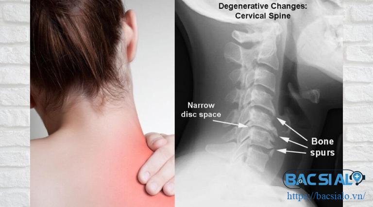 Chụp xquang chẩn đoán điều trị bệnh