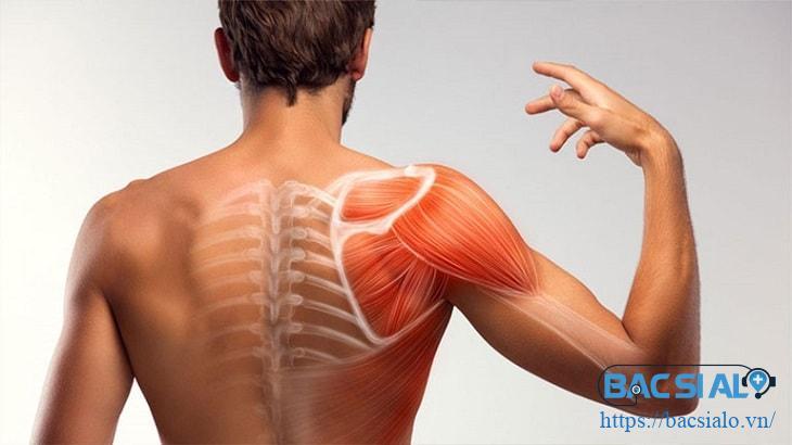 dau khop vai phai 1 min Các triệu chứng thường gặp khi bị đau vai