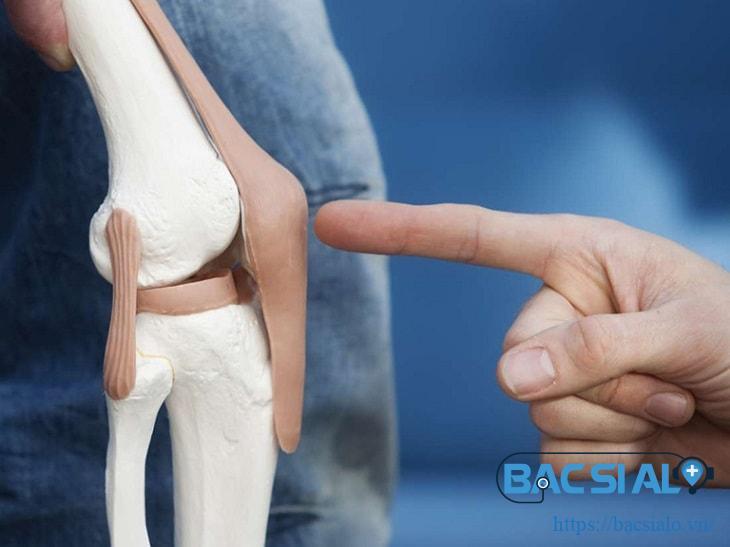 Viêm khớp gối tràn dịch có nguy hiểm không?