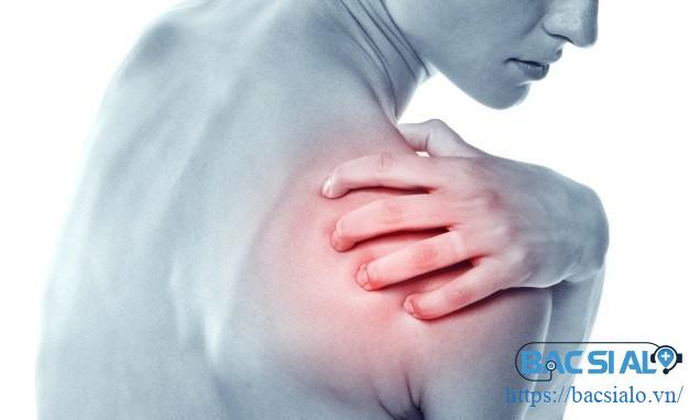 Khô khớp vai nguy hiểm vì có biến chứng