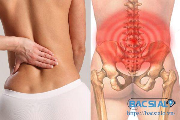 Hinh anh dau lung duoi Đau lưng là bệnh gì