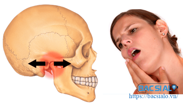viem khop thai duong ham 02 1 Viêm khớp thái dương hàm