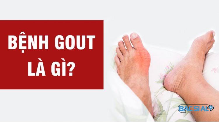 Tìm hiểu về bệnh gout