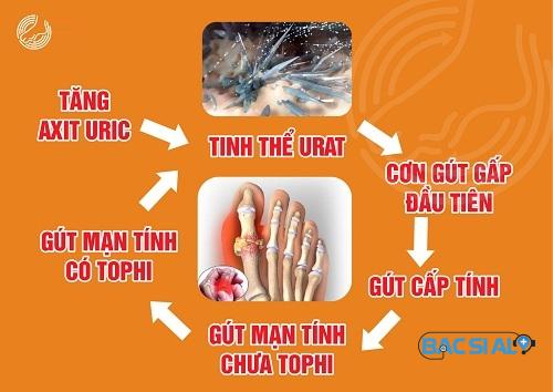 nguyen nhan gay benh gout nguyen nhan gay benh gout