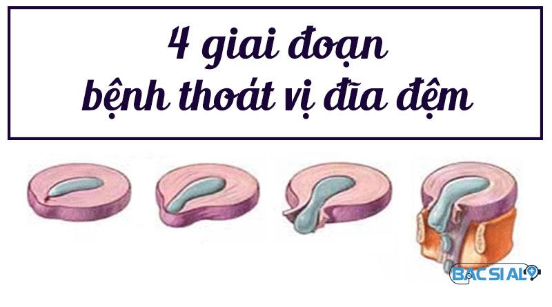 thoat vi dia dem cot song that lung thoat vi dia dem cot song that lung