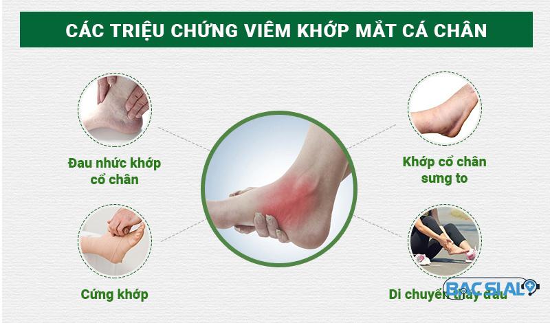 viem khop mat ca chan Viêm khớp mắt cá chân